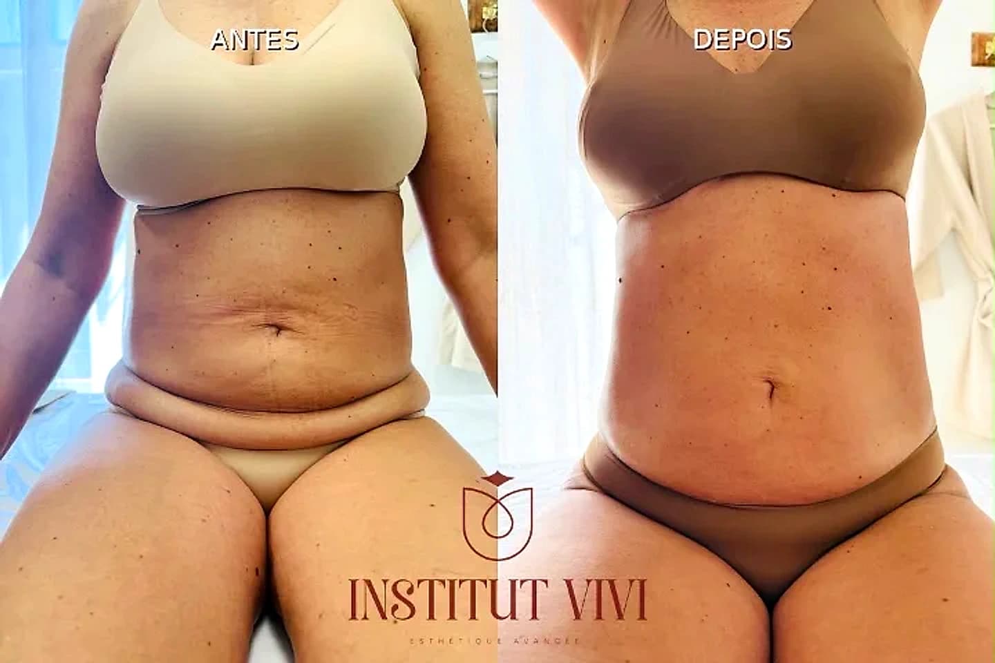Institut Vivi